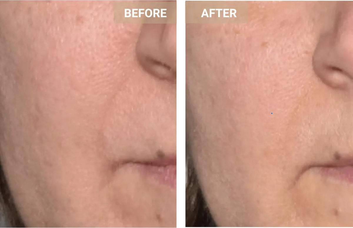 Mască Facială LED Anti-Aging Promagg, Lumină Roșie și Infraroșie - imagine 6