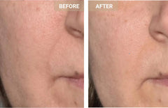 Mască Facială LED Anti-Aging Promagg, Lumină Roșie și Infraroșie