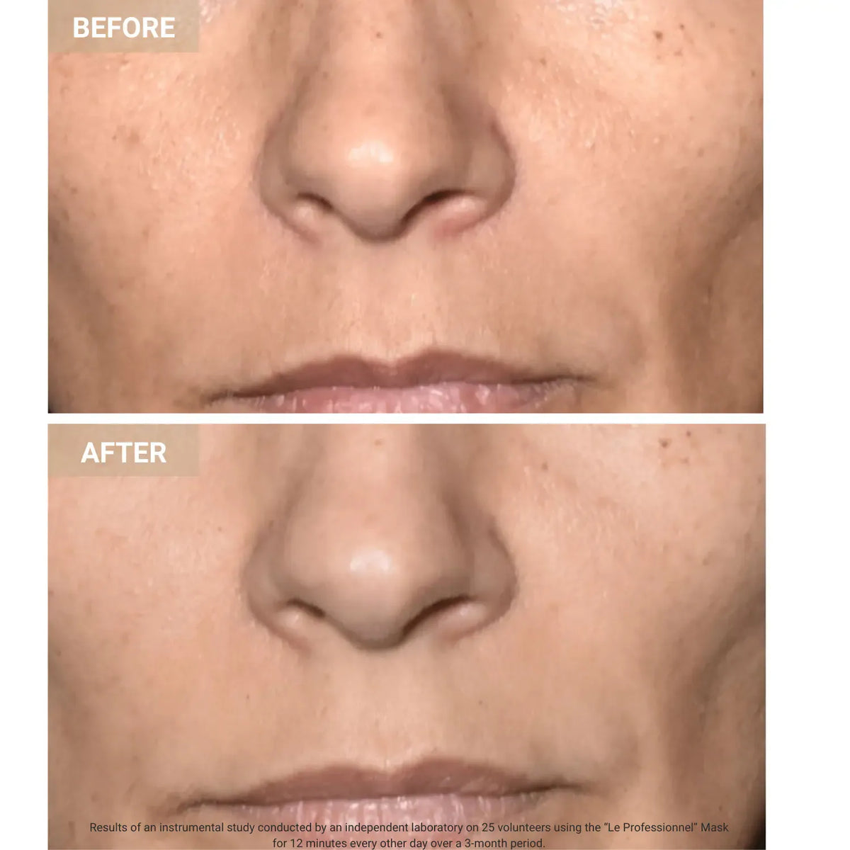 Mască Facială LED Anti-Aging Promagg, Lumină Roșie și Infraroșie - imagine 5