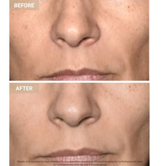 Mască Facială LED Anti-Aging Promagg, Lumină Roșie și Infraroșie